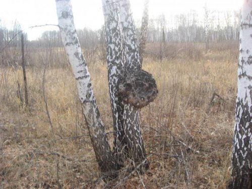 все как у людей.такие-же болячки!