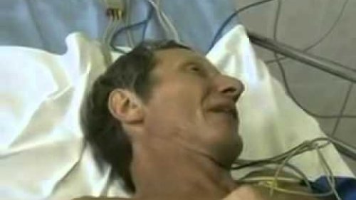 Человек умирает от бешенства