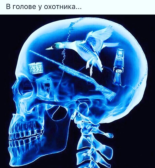 96f2b84604962546db9b6e2d1d3bd418.jpg